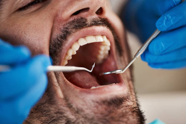 Best Emergency Dentist for Knocked-Out Tooth in Manteo, NC