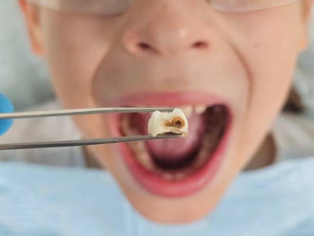 Best Pediatric Emergency Dentist in Manteo, NC